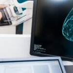 Therapixel, ou l’intelligence artificielle au chevet du diagnostic du cancer du sein