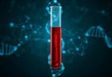 Un test sanguin pour détecter Alzheimer des années avant les premiers symptômes Tube à essai contenant du sang avec ADN et neurones en arrière-plan