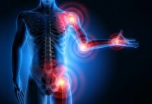 Collagène et articulations : ce que dit vraiment la science