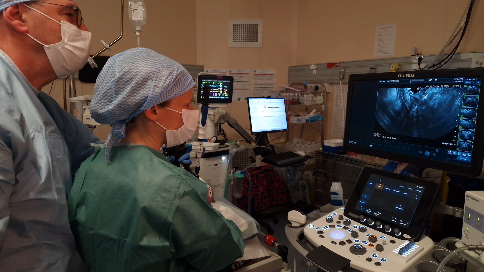 Capture d'écran 2026-05-07 110437 Pose de bâtonnets radioactifs sous échoendoscopie dans une tumeur du pancréas, en salle d'endoscopie au CHU Grenoble Alpes